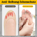 Anti-Reibungs-Zehenschutz aus Silikon